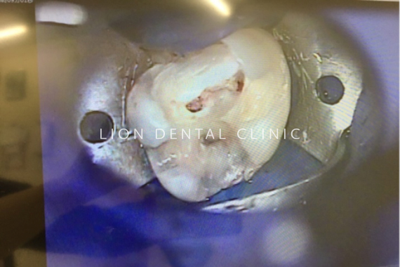 マイクロスコープ