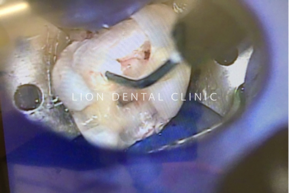 マイクロスコープ