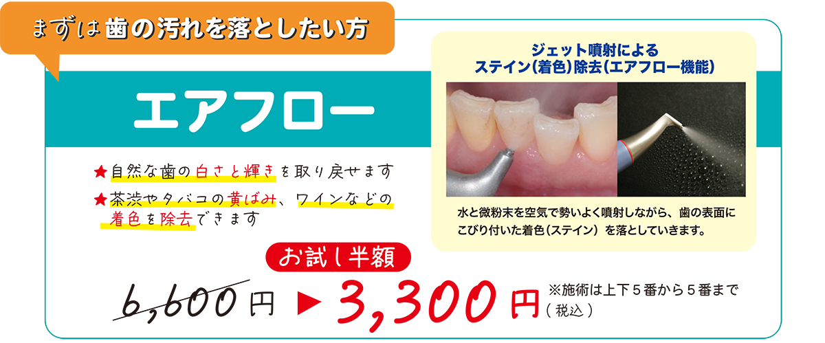 まずは歯の汚れを落としたい方にエアフロー 通常6,600円が半額の3,300円（税込）